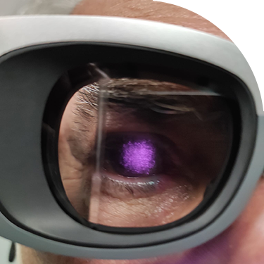 Un microchip combatte la cecità nelle distrofie retiniche 